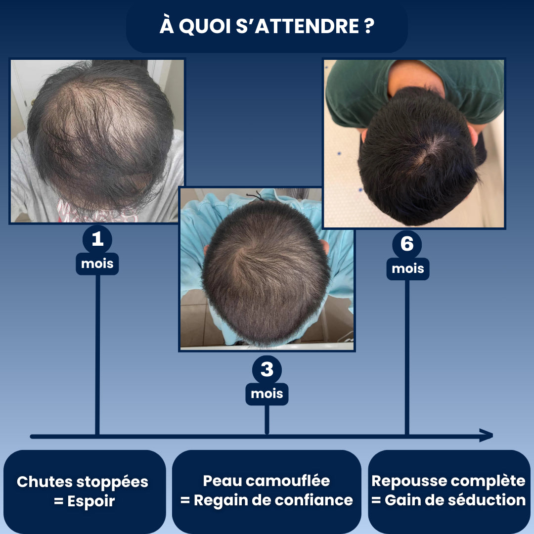 Technologie Micro Infusion™ Capillaire