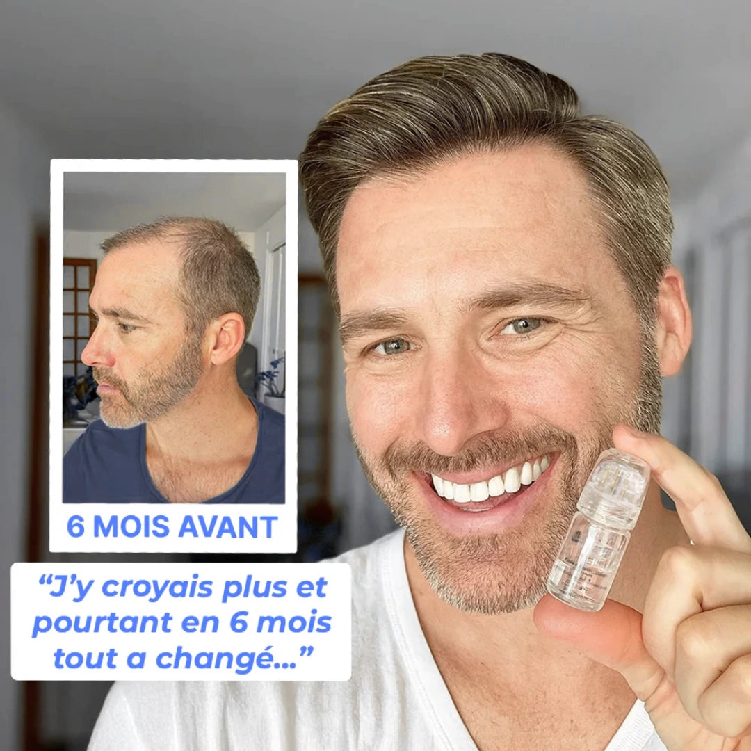 Technologie Micro Infusion™ Capillaire