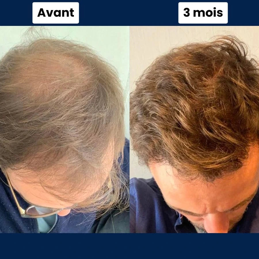 Technologie Micro Infusion™ Capillaire