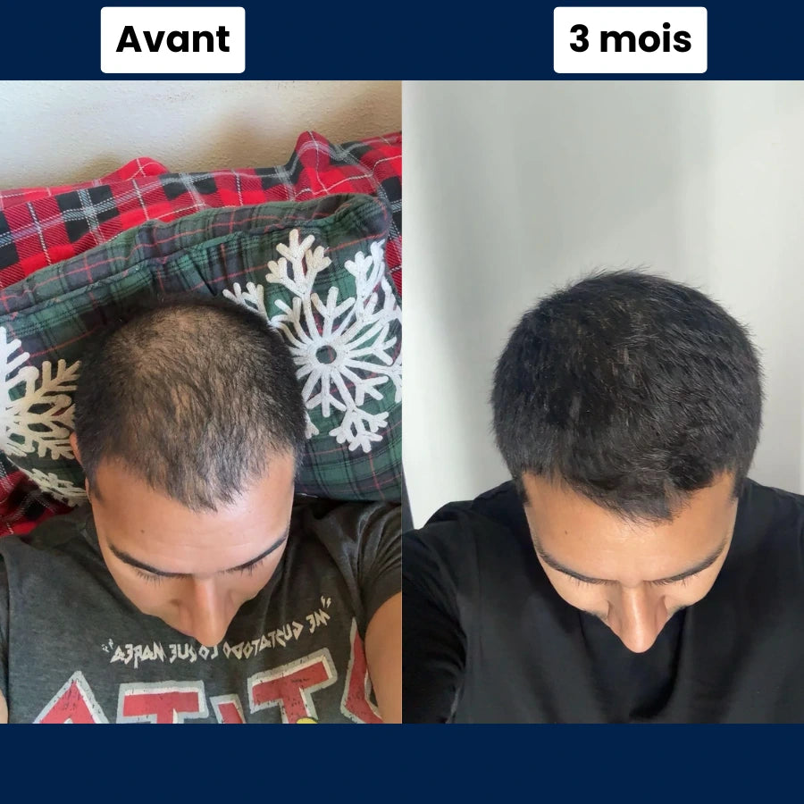 Technologie Micro Infusion™ Capillaire